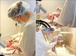 实拍剖腹产手术全过程
