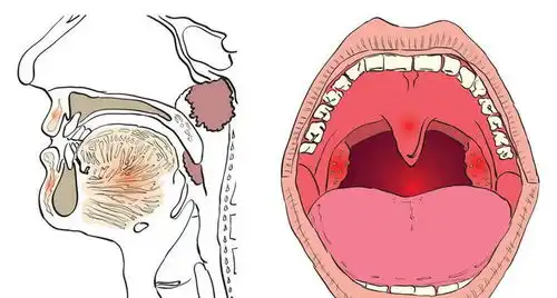 全国爱鼻日关爱儿童鼻腔,守护气道健康