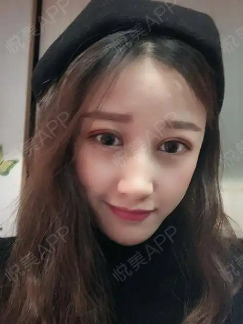 这两天刷抖音全都是猫和老鼠,老版新版剪辑贼多,但是...颧骨颧弓整形悦美整形