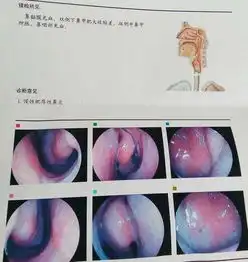 首大医院耳鼻喉医生崔付军肥厚性鼻炎危害有多大不了解肥厚性鼻炎的看这里