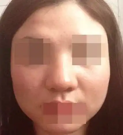 为什么你的高鼻子还不如人家的塌鼻子好看