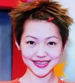 娱乐圈又刮起了整牙风,整个牙也可以变张脸
