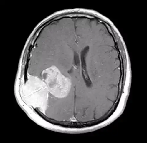 难以直视的15幅人体透视图,简直了