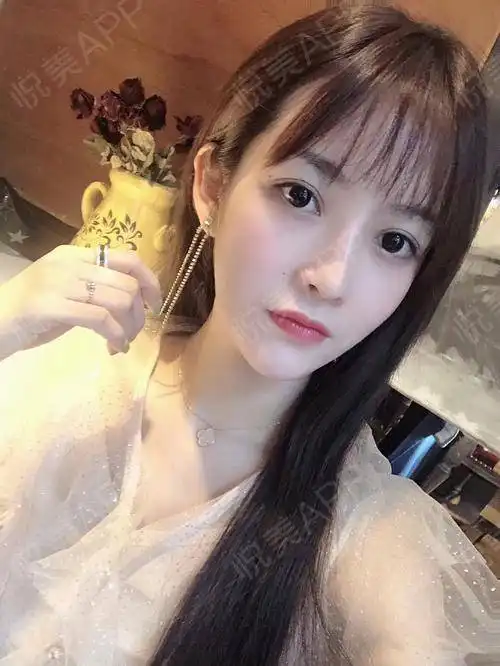 感谢关注我的小姐妹们,谢谢你们的赞赏,其实我觉得自...面部填充悦美整形