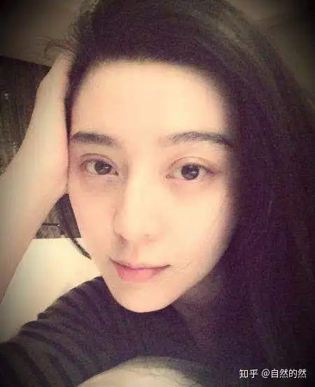 关于双眼皮,你想知道的一切都在这里