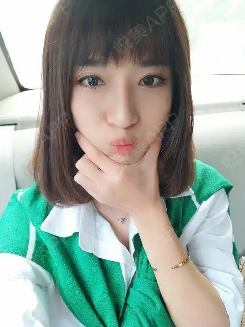 卡哇伊的呢,小猫猫的表情是不是很可爱的呀,火箭...垫鼻尖悦美整形